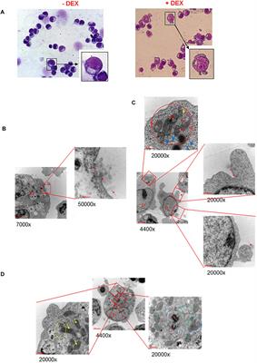 Dexamethasone Predisposes Human Erythroblasts Toward Impaired Lipid Metabolism and Renders Their ex vivo Expansion Highly Dependent on Plasma Lipoproteins